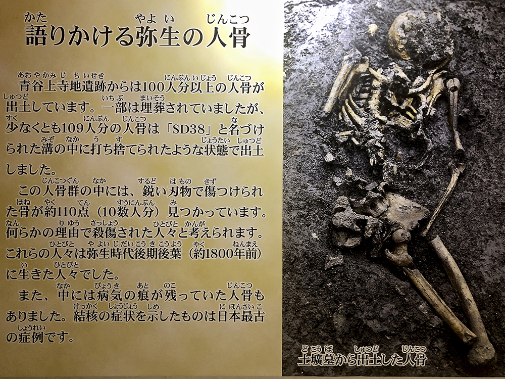 青谷上寺地遺跡の人骨