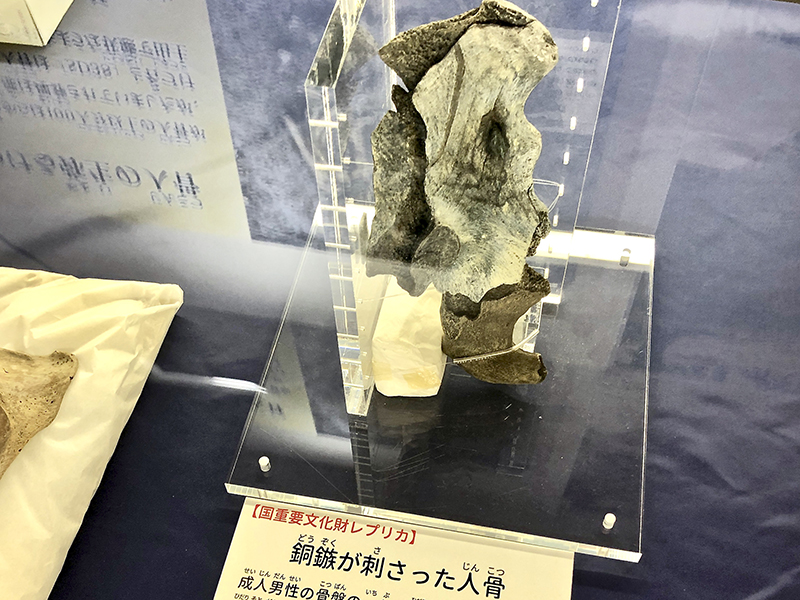 銅鏃が刺さった人骨